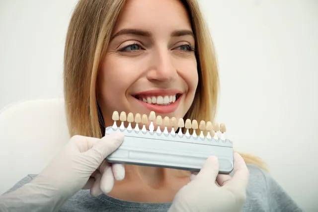 Cosmetic dentistry shade matching